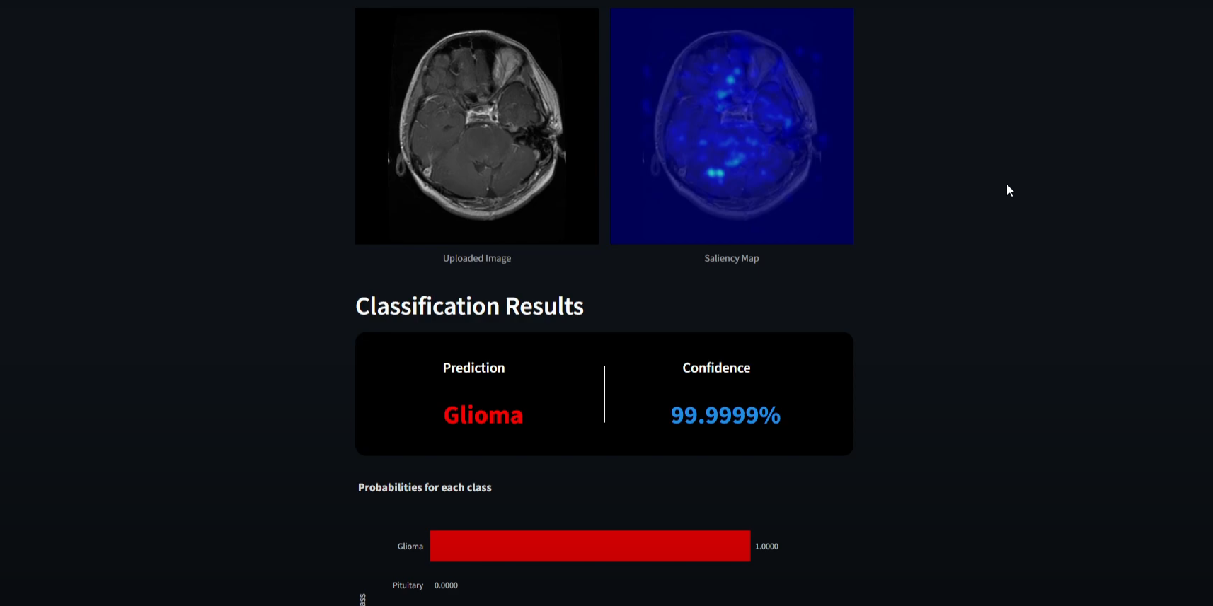 Brain Tumor Classification